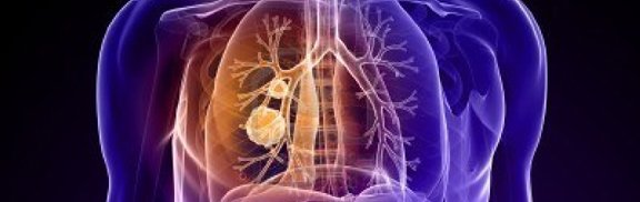  Le cancer du poumon bientôt une maladie curable