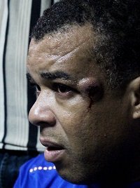  Haïti: des manifestants de l’opposition blessés par la police